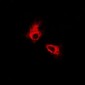Anti-FOXO3 Antibody